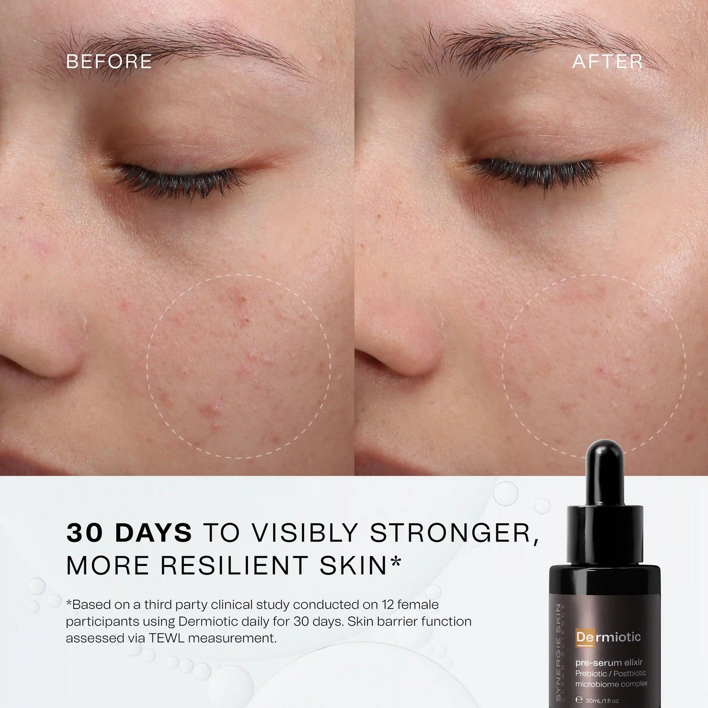 Synergie - Dermiotic (pre serum elixir)