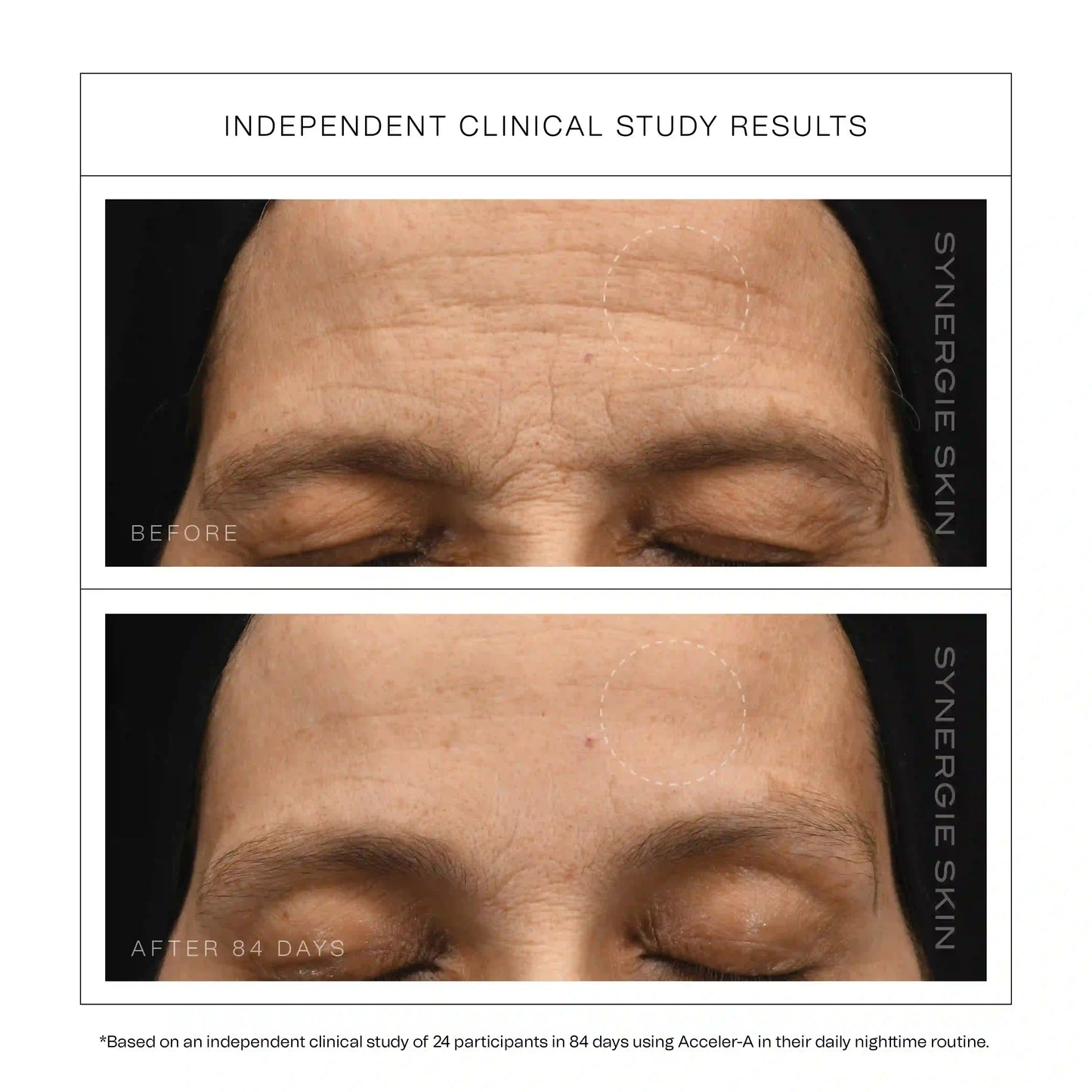 Synergie - Acceler-A (advanced vitamin A serum)