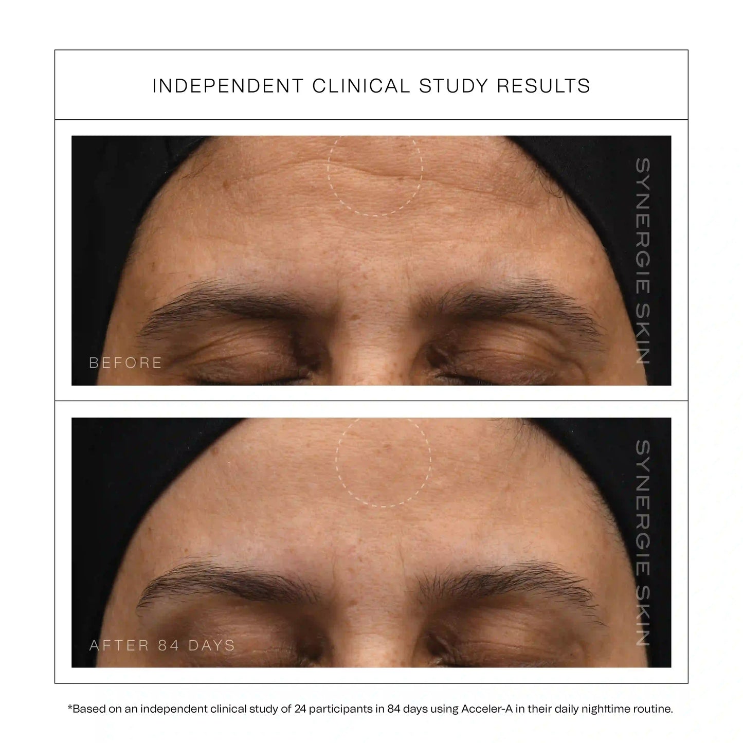 Synergie - Acceler-A (advanced vitamin A serum)