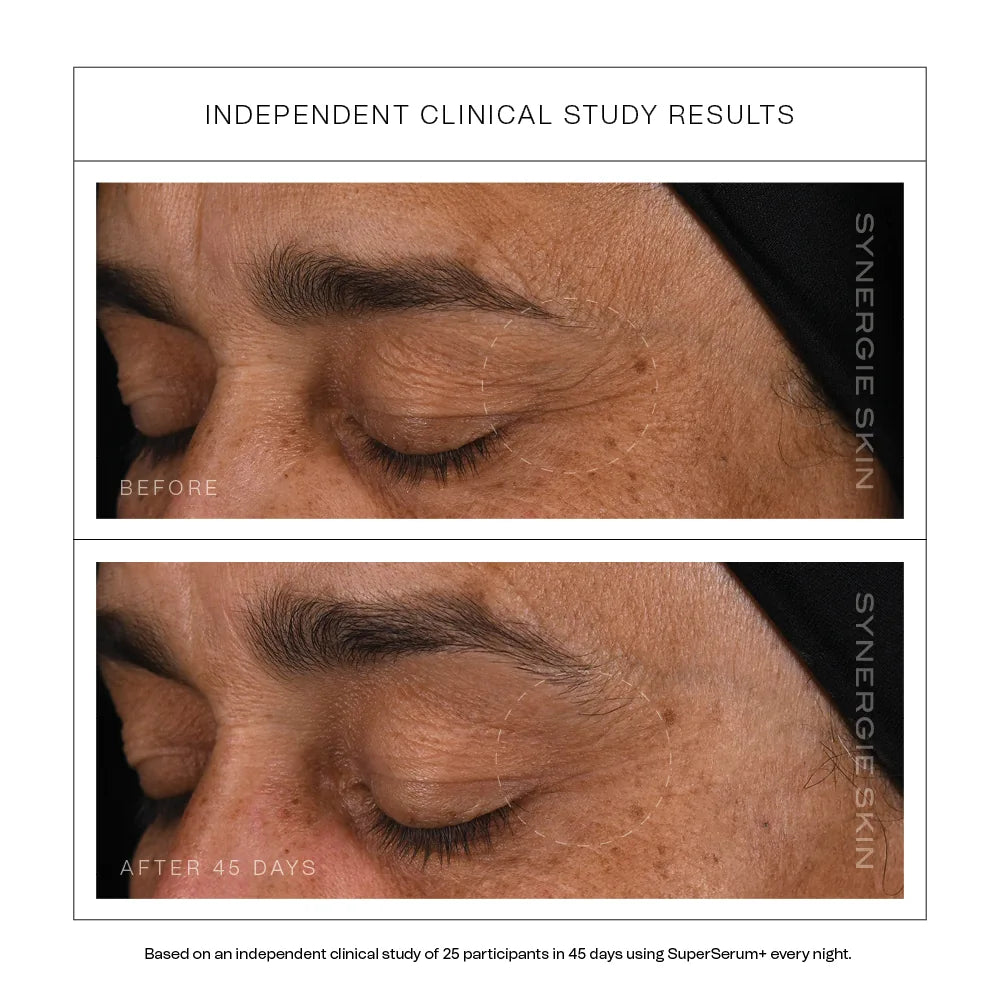 Synergie - SuperSerum+ (youth renewal serum)
